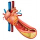 Средства при ишемической болезни сердца